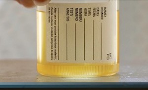 DUI Urine Test